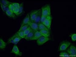 HOMER1 Rabbit anti-Human, Mouse, Rat, Polyclonal, Proteintech:Antibodies:Primary