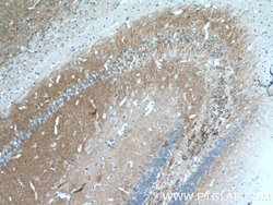 HOMER1 Rabbit anti-Human, Mouse, Rat, Polyclonal, Proteintech:Antibodies:Primary