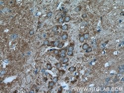 HOMER1 Rabbit anti-Human, Mouse, Rat, Polyclonal, Proteintech:Antibodies:Primary