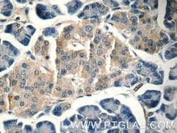 HOMER1 Rabbit anti-Human, Mouse, Rat, Polyclonal, Proteintech:Antibodies:Primary