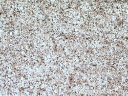 HOMER1 Rabbit anti-Human, Mouse, Rat, Polyclonal, Proteintech:Antibodies:Primary
