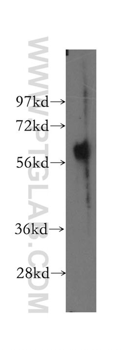 ESAM Rabbit anti-Human, Mouse, Rat, Polyclonal, Proteintech 20 &mu;L; Unconjugated:Antibodies,