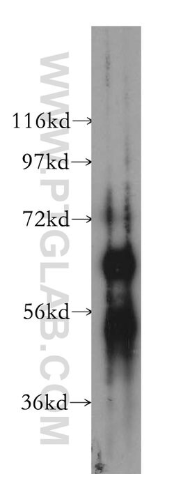 ESAM Rabbit anti-Human, Mouse, Rat, Polyclonal, Proteintech 20 &mu;L; Unconjugated:Antibodies,