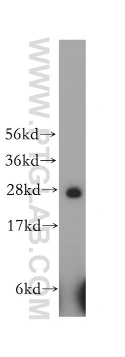 HS2ST1 Rabbit anti-Human, Polyclonal, Proteintech:Antibodies:Primary Antibodies