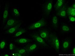 KPNA4 Rabbit anti-Human, Mouse, Rat, Polyclonal, Proteintech:Antibodies:Primary