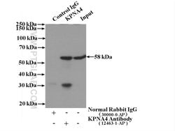 KPNA4 Rabbit anti-Human, Mouse, Rat, Polyclonal, Proteintech:Antibodies:Primary