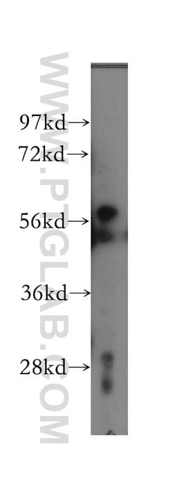 KPNA4 Rabbit anti-Human, Mouse, Rat, Polyclonal, Proteintech:Antibodies:Primary