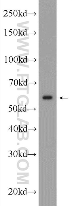 KPNA4 Rabbit anti-Human, Mouse, Rat, Polyclonal, Proteintech:Antibodies:Primary