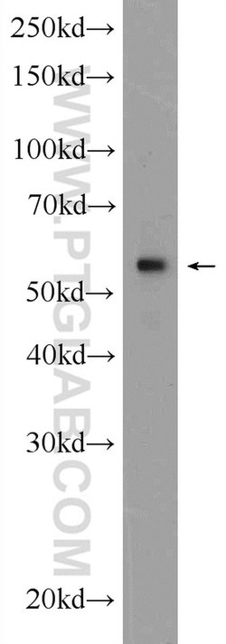 KPNA4 Rabbit anti-Human, Mouse, Rat, Polyclonal, Proteintech:Antibodies:Primary