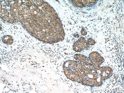PANK1/2/3 Rabbit anti-Human, Mouse, Rat, Polyclonal, Proteintech:Antibodies:Primary