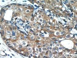 PANK1/2/3 Rabbit anti-Human, Mouse, Rat, Polyclonal, Proteintech:Antibodies:Primary