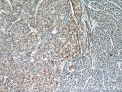 PANK1/2/3 Rabbit anti-Human, Mouse, Rat, Polyclonal, Proteintech:Antibodies:Primary