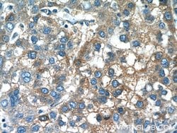 PANK1/2/3 Rabbit anti-Human, Mouse, Rat, Polyclonal, Proteintech:Antibodies:Primary