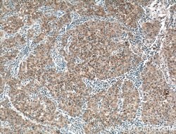 PANK1/2/3 Rabbit anti-Human, Mouse, Rat, Polyclonal, Proteintech:Antibodies:Primary
