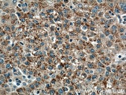 PANK1/2/3 Rabbit anti-Human, Mouse, Rat, Polyclonal, Proteintech:Antibodies:Primary