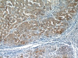 PANK1/2/3 Rabbit anti-Human, Mouse, Rat, Polyclonal, Proteintech:Antibodies:Primary