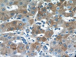 PANK1/2/3 Rabbit anti-Human, Mouse, Rat, Polyclonal, Proteintech:Antibodies:Primary