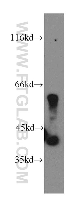 PANK1/2/3 Rabbit anti-Human, Mouse, Rat, Polyclonal, Proteintech:Antibodies:Primary