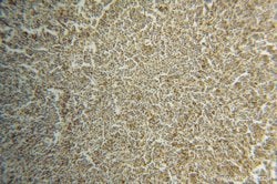 LCK Rabbit anti-Human, Mouse, Rat, Polyclonal, Proteintech:Antikörper:Primärantikörper