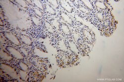 TPP1 Rabbit anti-Human, Mouse, Rat, Polyclonal, Proteintech 150 &mu;L;