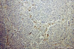 TPP1 Rabbit anti-Human, Mouse, Rat, Polyclonal, Proteintech 150 &mu;L;