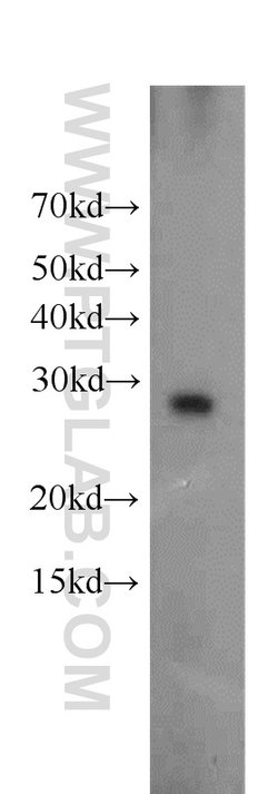 Ephrin A3 Rabbit anti-Human, Mouse, Rat, Polyclonal, Proteintech:Antibodies:Primary