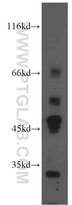 Ephrin A3 Rabbit anti-Human, Mouse, Rat, Polyclonal, Proteintech:Antibodies:Primary