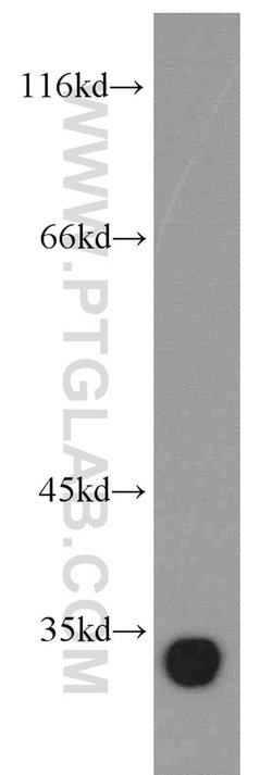 Ephrin A3 Rabbit anti-Human, Mouse, Rat, Polyclonal, Proteintech:Antibodies:Primary