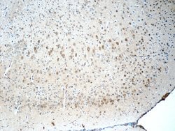 CYP46A1 Rabbit anti-Human, Mouse, Rat, Polyclonal, Proteintech:Antibodies:Primary