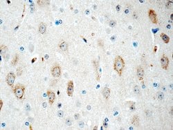 CYP46A1 Rabbit anti-Human, Mouse, Rat, Polyclonal, Proteintech:Antibodies:Primary