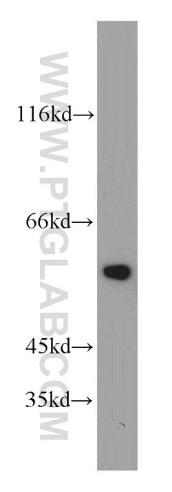 CYP46A1 Rabbit anti-Human, Mouse, Rat, Polyclonal, Proteintech:Antibodies:Primary