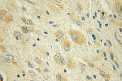 CYP46A1 Rabbit anti-Human, Mouse, Rat, Polyclonal, Proteintech:Antibodies:Primary