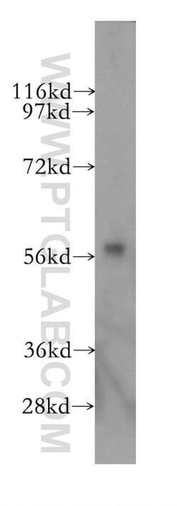 CYP46A1 Rabbit anti-Human, Mouse, Rat, Polyclonal, Proteintech:Antibodies:Primary