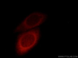 TBL2 Rabbit anti-Human, Mouse, Rat, Polyclonal, Proteintech:Antibodies:Primary
