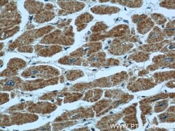 TBL2 Rabbit anti-Human, Mouse, Rat, Polyclonal, Proteintech:Antibodies:Primary