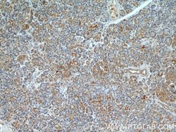 TBL2 Rabbit anti-Human, Mouse, Rat, Polyclonal, Proteintech:Antibodies:Primary