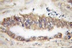 TBL2 Rabbit anti-Human, Mouse, Rat, Polyclonal, Proteintech:Antibodies:Primary