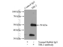 TBL2 Rabbit anti-Human, Mouse, Rat, Polyclonal, Proteintech:Antibodies:Primary