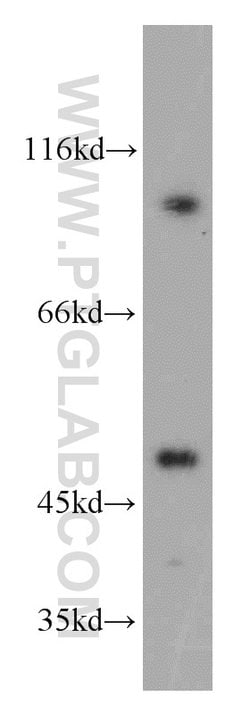 TBL2 Rabbit anti-Human, Mouse, Rat, Polyclonal, Proteintech:Antibodies:Primary