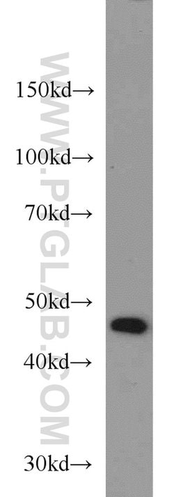 TBL2 Rabbit anti-Human, Mouse, Rat, Polyclonal, Proteintech:Antibodies:Primary