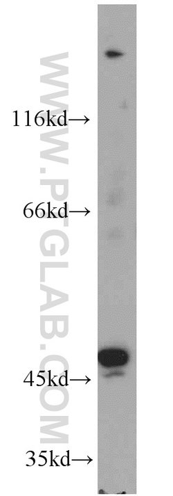 TBL2 Rabbit anti-Human, Mouse, Rat, Polyclonal, Proteintech:Antibodies:Primary