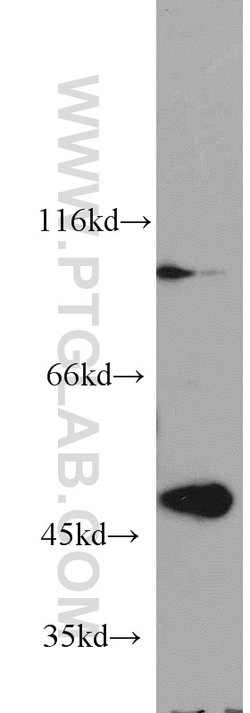 TBL2 Rabbit anti-Human, Mouse, Rat, Polyclonal, Proteintech:Antibodies:Primary