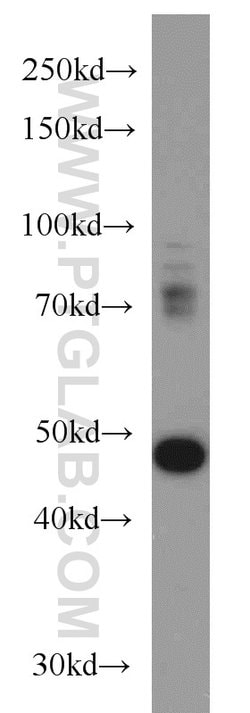 TBL2 Rabbit anti-Human, Mouse, Rat, Polyclonal, Proteintech:Antibodies:Primary