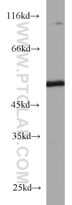 TBL2 Rabbit anti-Human, Mouse, Rat, Polyclonal, Proteintech:Antibodies:Primary