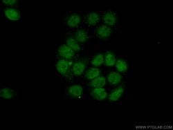 USP3 Rabbit anti-Human, Mouse, Polyclonal, Proteintech:Antibodies:Primary