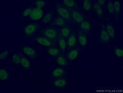 USP3 Rabbit anti-Human, Mouse, Polyclonal, Proteintech:Antibodies:Primary