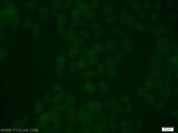 USP3 Rabbit anti-Human, Mouse, Polyclonal, Proteintech:Antibodies:Primary