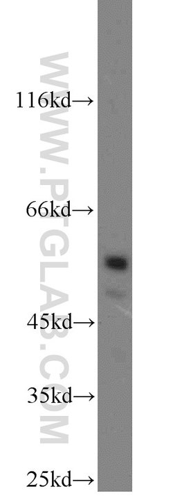 USP3 Rabbit anti-Human, Mouse, Polyclonal, Proteintech:Antibodies:Primary