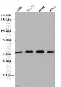 USP3 Rabbit anti-Human, Mouse, Polyclonal, Proteintech:Antibodies:Primary