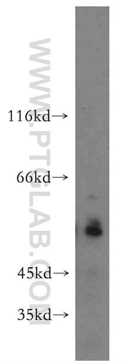 USP3 Rabbit anti-Human, Mouse, Polyclonal, Proteintech:Antibodies:Primary
